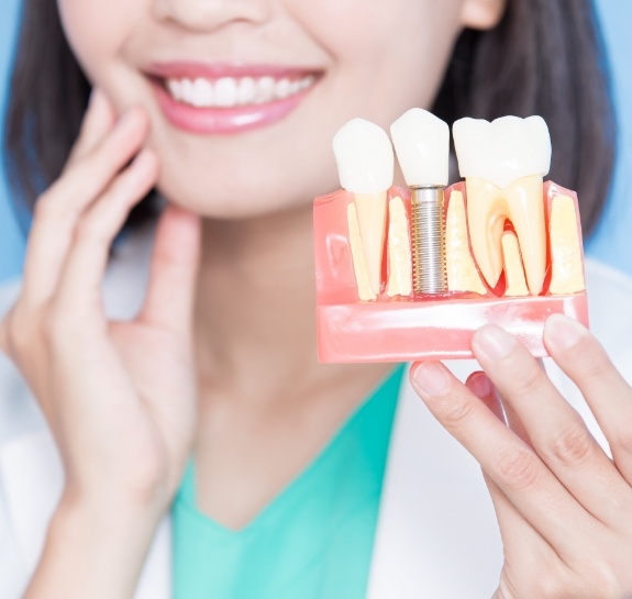 Dentist holding a model of a dental implant