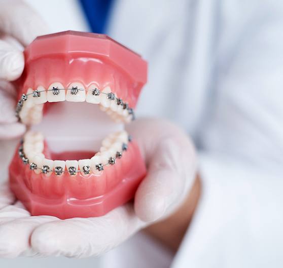 White-gloved hands holding set of model teeth with braces