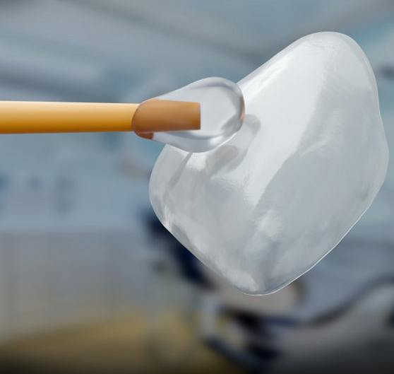 a veneer being held with a dental tool