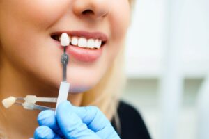 Nose to chin view of dentist holding sample veneers to patient's teeth