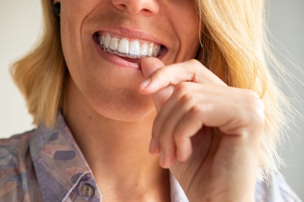 Nose-to-neck view of woman with blond hair pressing Invisalign over top teeth with thumb