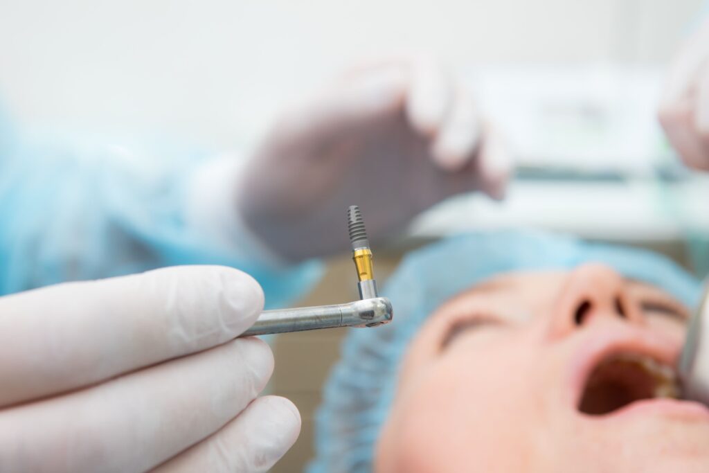 Closeup of dental implant before dentist places it surgically in patients mouth